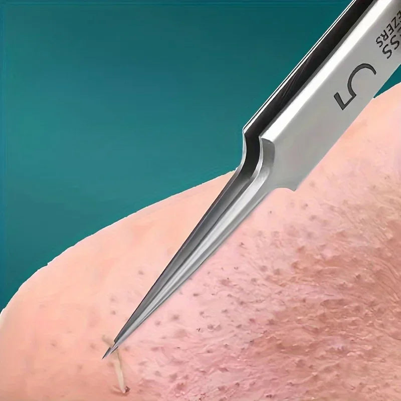 Stainless Steel Acne Extraction Kit For Professional Skincare