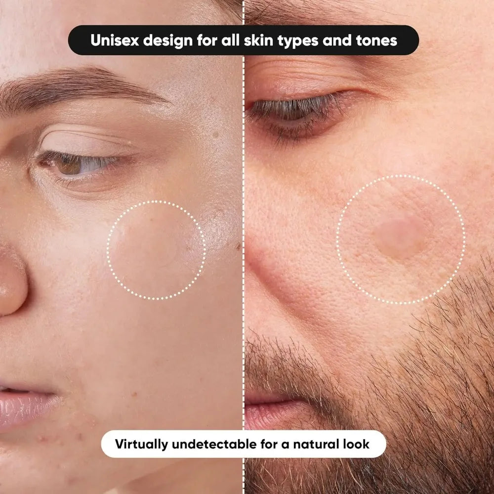 Gentle Hydrocolloid Round Acne Patches Overnight Healing And Visible Results