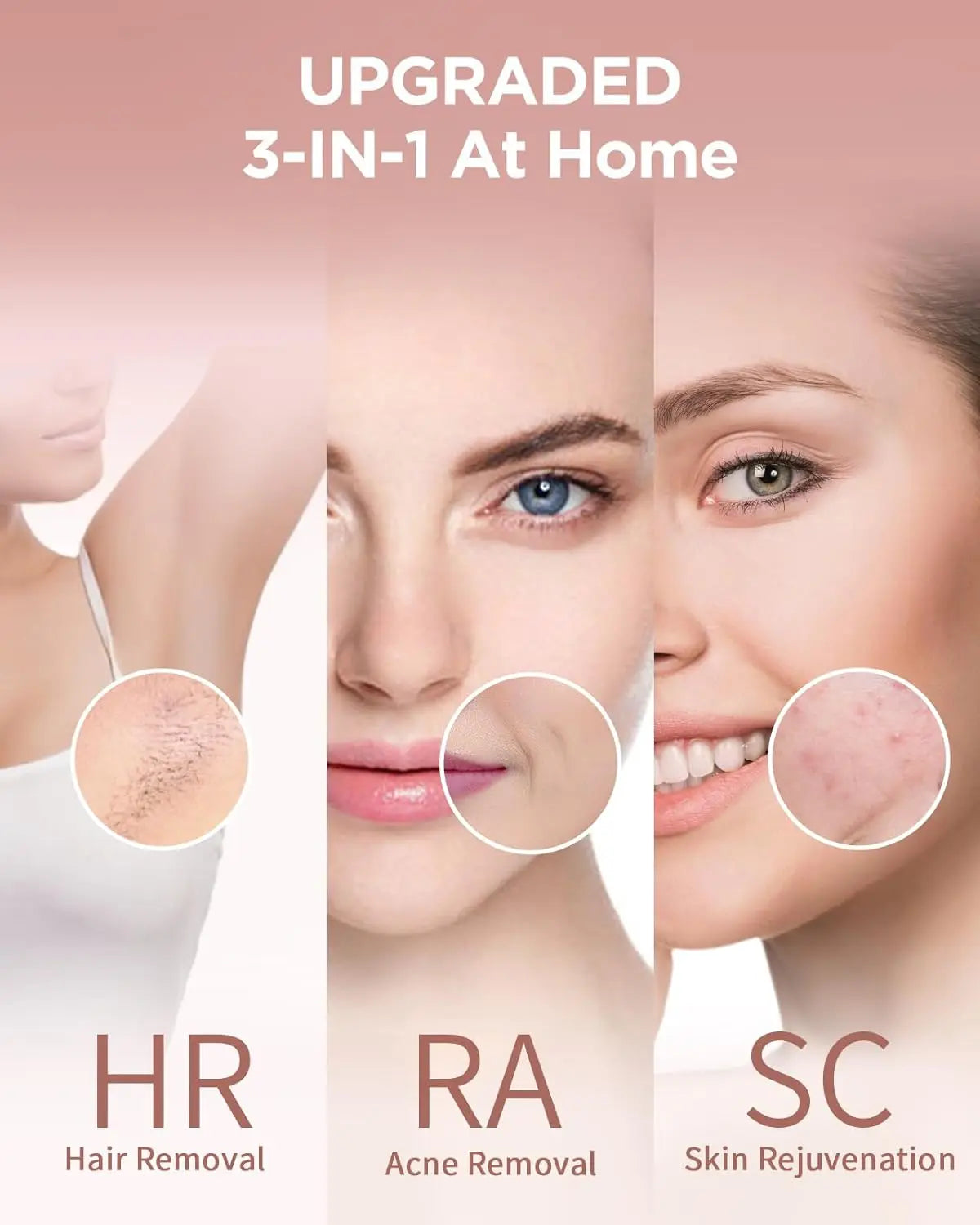 JOOYEE IPL Hair Removal Epilator For Face And Body Treatment