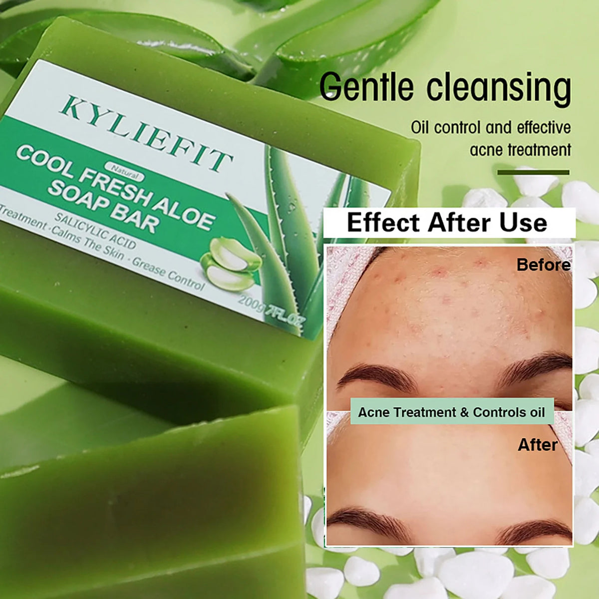 AILKE Aloe Brightening Soap Bar Clears Acne And Evens Skin Tone