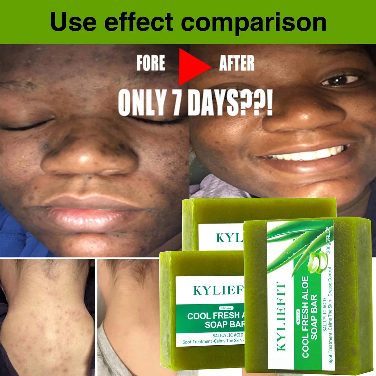 AILKE Aloe Brightening Soap Bar Clears Acne And Evens Skin Tone