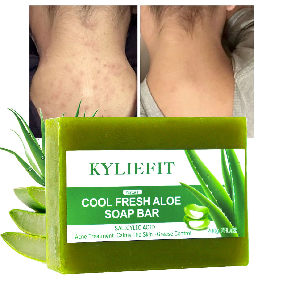 AILKE Aloe Brightening Soap Bar Clears Acne And Evens Skin Tone