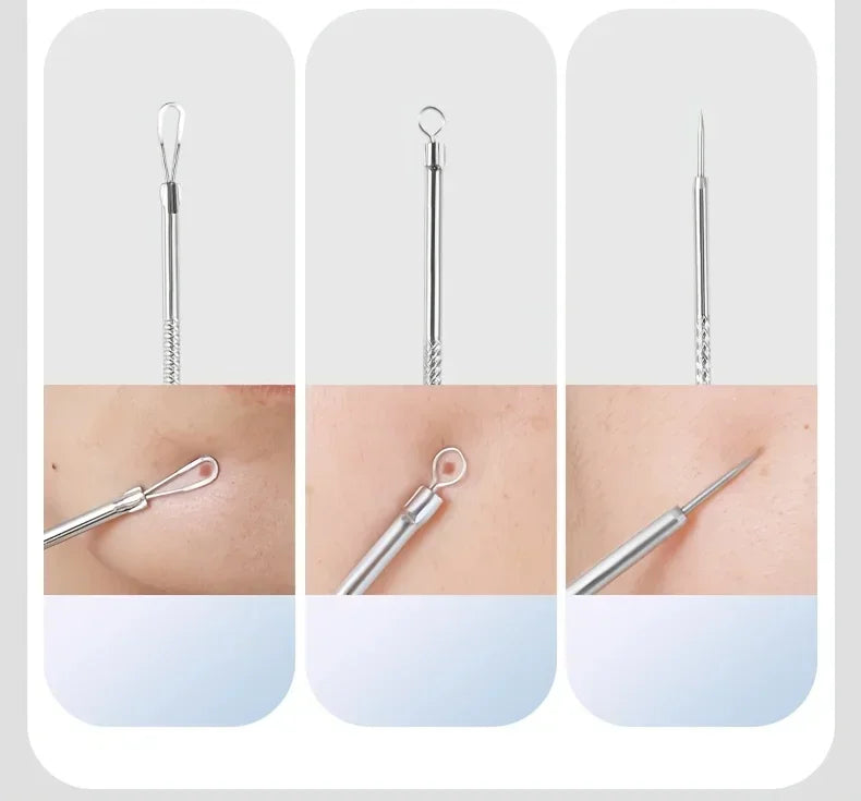 Stainless Steel Acne Extraction Kit For Professional Skincare