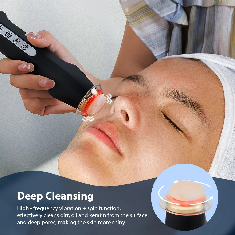 Foreverlily CO2 Oxygen Bubble Facial Pen For Skin Rejuvenation
