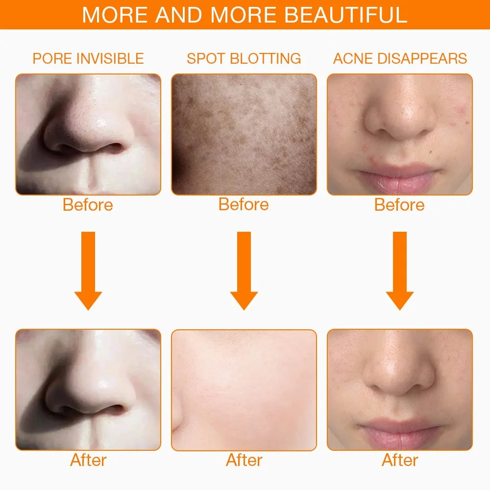 Iebilif Led Facial Mask For Anti Aging Skin Rejuvenation
