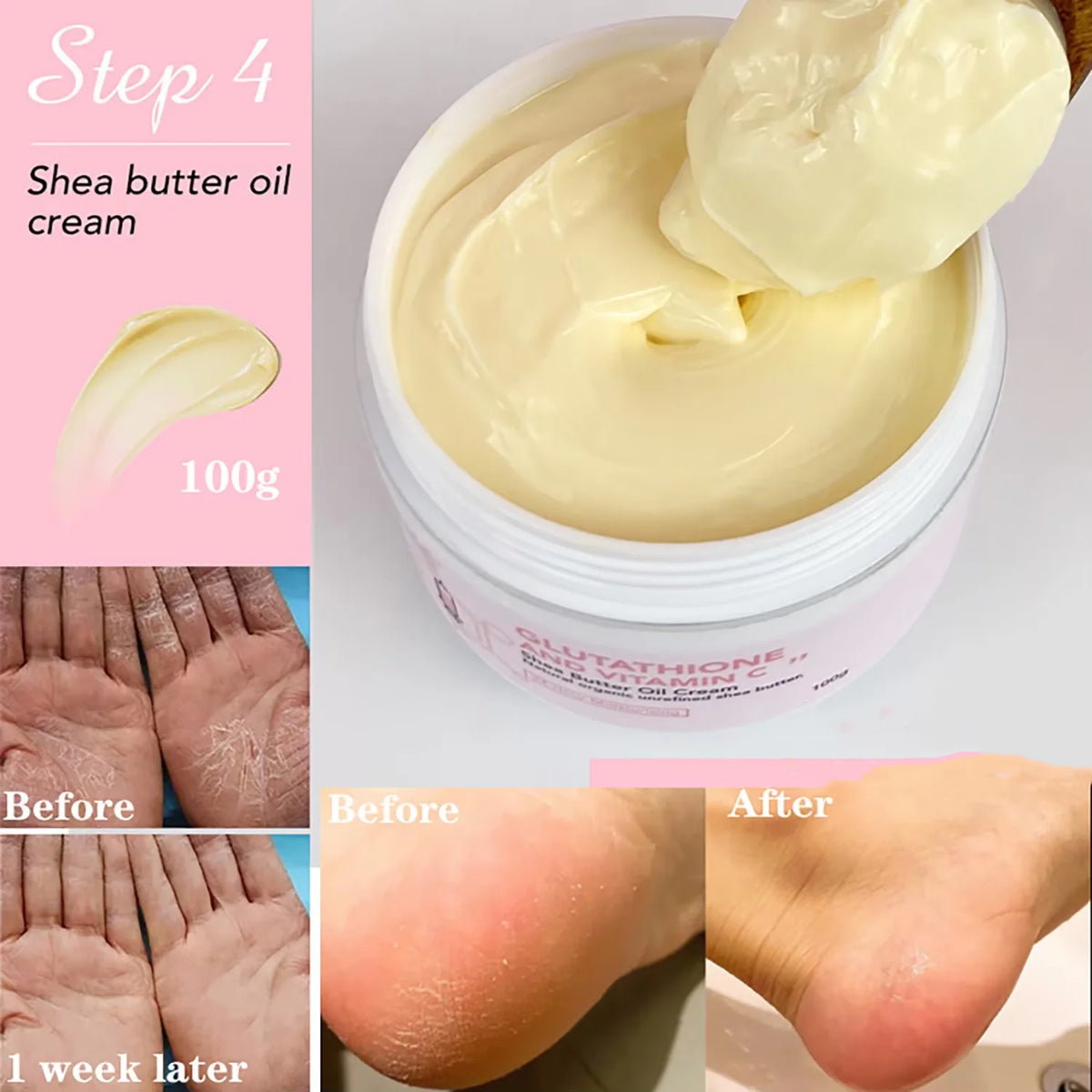 AILKE Natural Whitening Face And Body Cream With Shea Butter