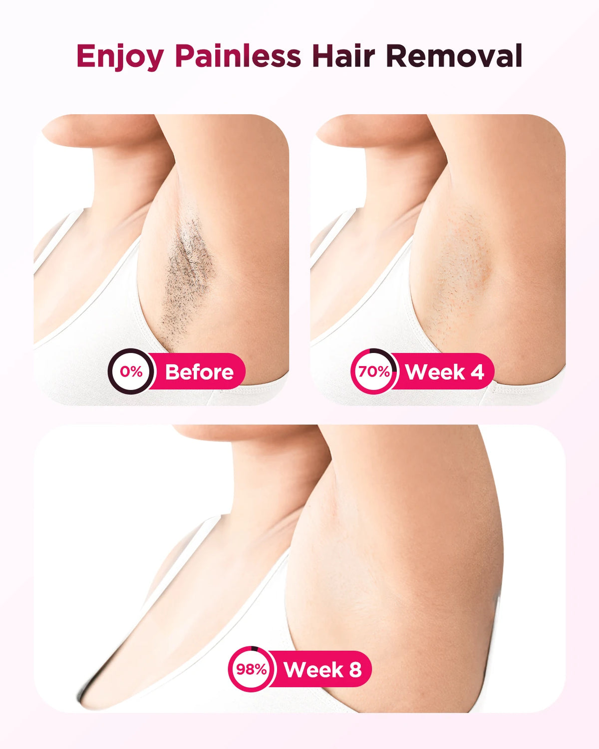 Totmizby IPL Laser Hair Removal Device For Men And Women