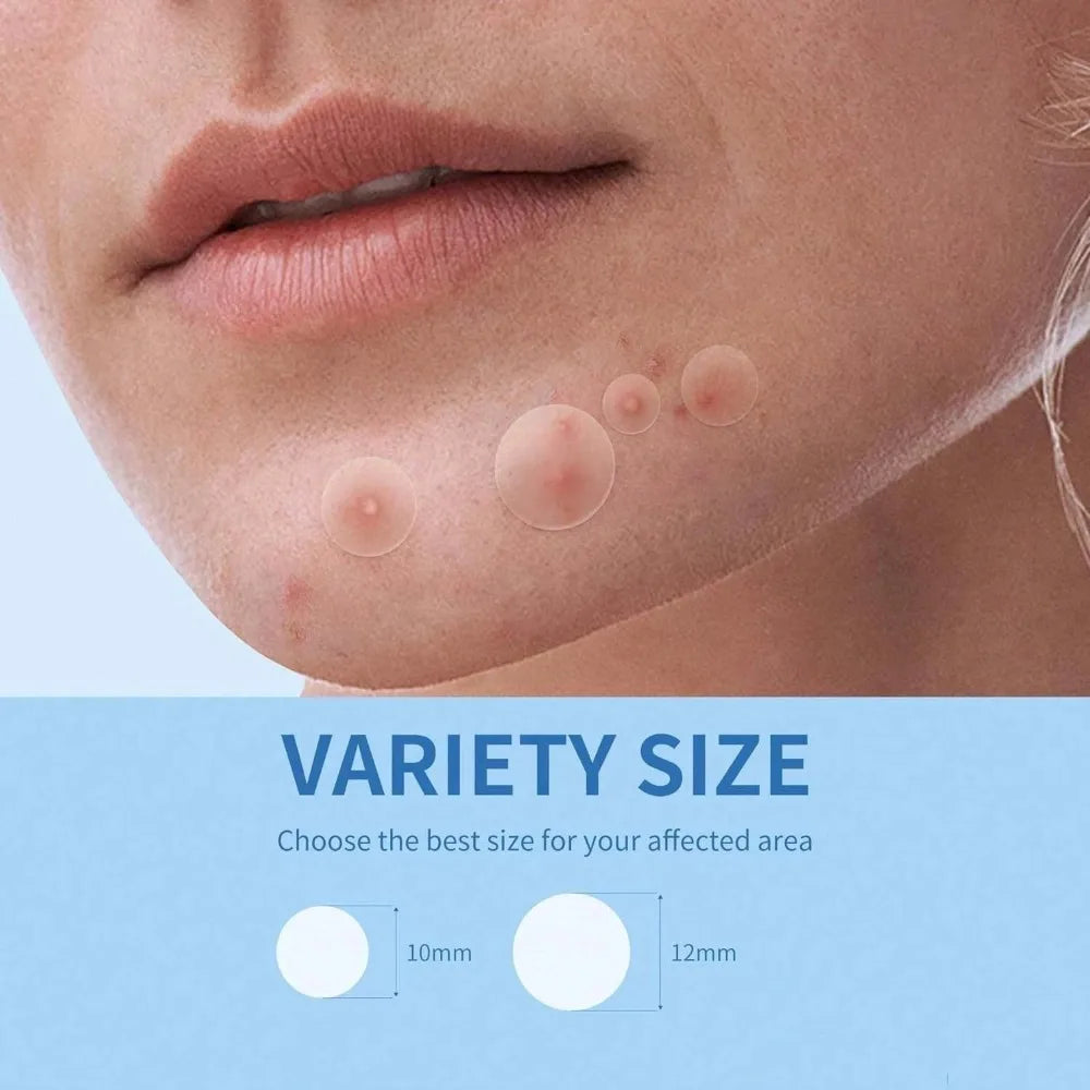 Gentle Hydrocolloid Round Acne Patches Overnight Healing And Visible Results