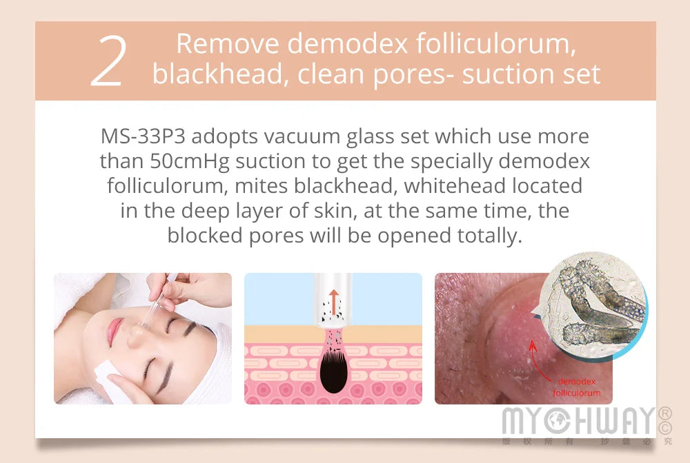 Mychway 3 In 1 Ultrasound Dermabrasion Beauty Face Cleanser