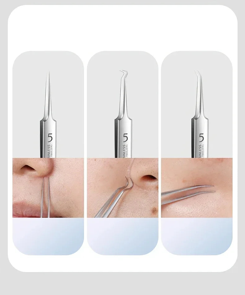 Stainless Steel Acne Extraction Kit For Professional Skincare